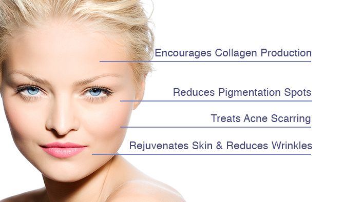 Microneedling services